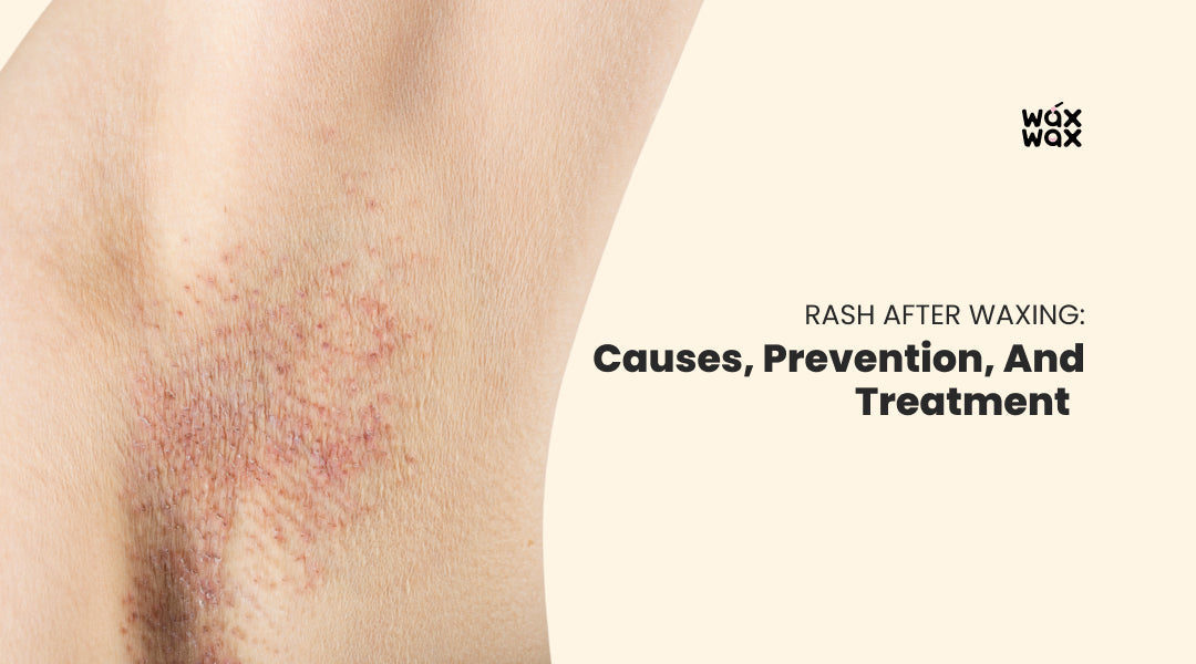 Rash After Waxing: Causes, Prevention, and Treatment