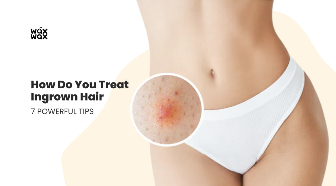 How Do You Treat Ingrown Hair: 7 Powerful Tips