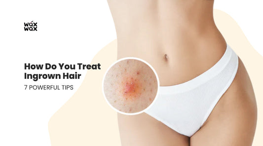 How Do You Treat Ingrown Hair: 7 Powerful Tips