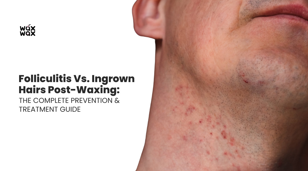 Folliculitis vs. Ingrown Hairs Post-Waxing: The Complete Prevention & Treatment Guide