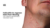Folliculitis vs. Ingrown Hairs Post-Waxing: The Complete Prevention & Treatment Guide