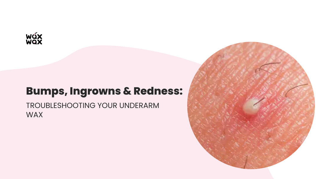 Bumps, Ingrowns & Redness: Troubleshooting Your Underarm Wax