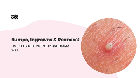 Bumps, Ingrowns & Redness: Troubleshooting Your Underarm Wax