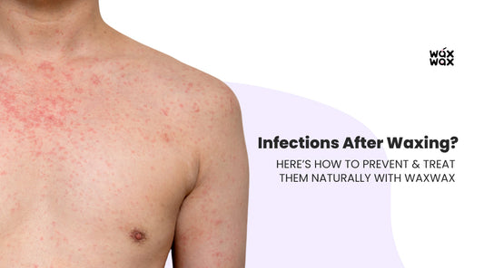 Infections After Waxing? Here’s How to Prevent & Treat Them Naturally with WaxWax