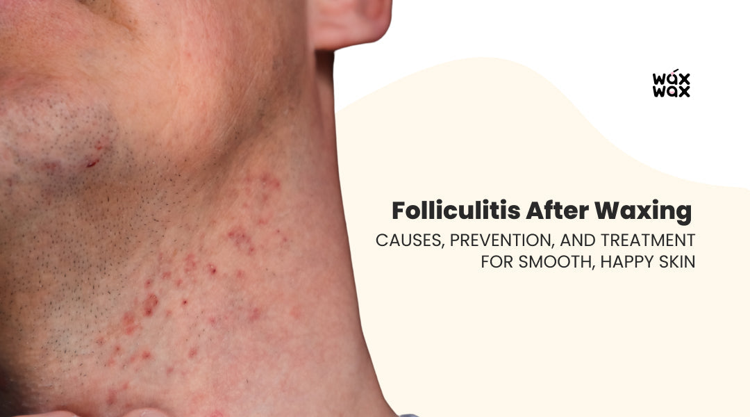 Folliculitis After Waxing: Causes, Prevention, and Treatment for Smooth, Happy Skin