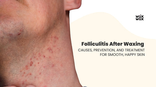 Folliculitis After Waxing: Causes, Prevention, and Treatment for Smooth, Happy Skin