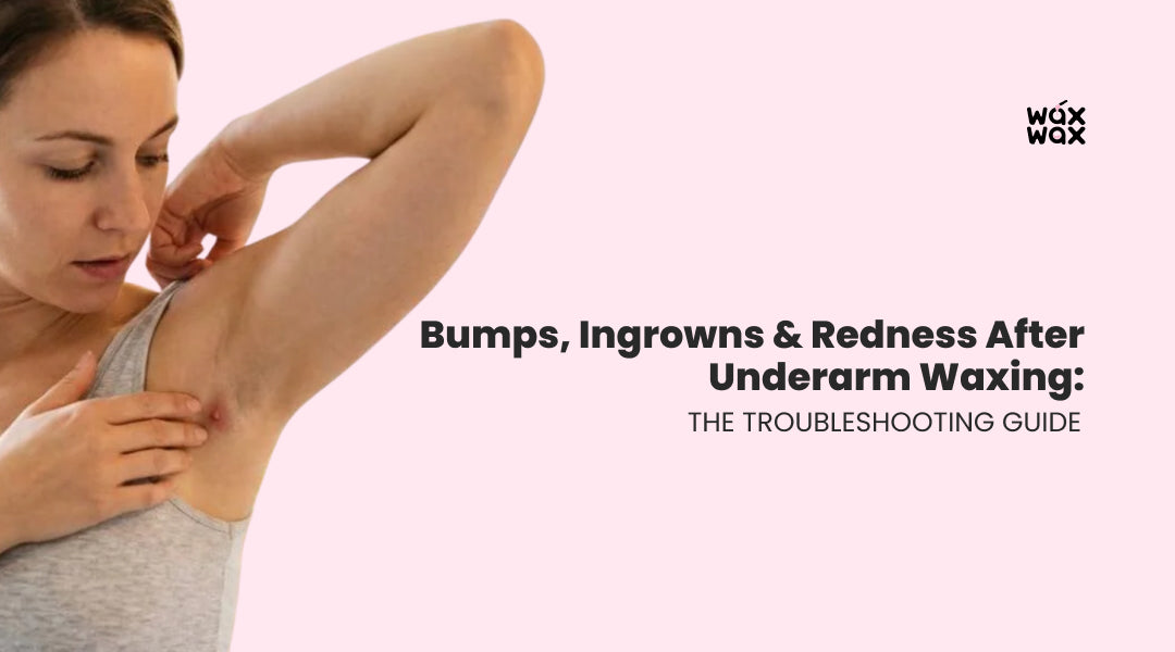 Bumps, Ingrowns & Redness After Underarm Waxing: The Troubleshooting Guide