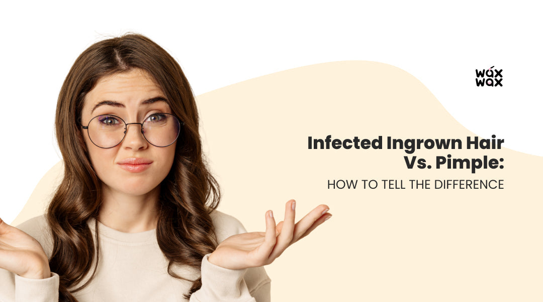 Infected Ingrown Hair vs. Pimple: How to Tell the Difference